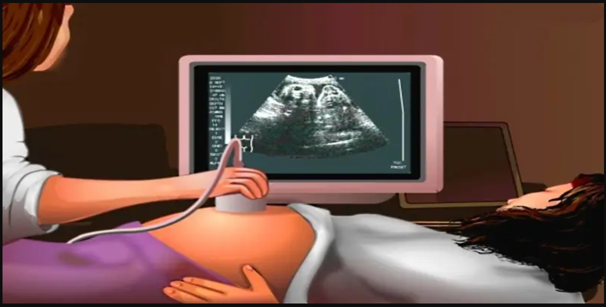 How Color Doppler Ultrasound is different from normal ultrasound