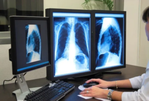 How Radiologists Help Detect Health Issues Early?